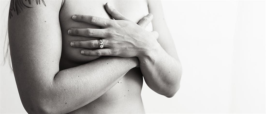 Καρκίνος μαστού: ποιες γυναίκες έχουν μεγαλύτερο κίνδυνο για μετάσταση